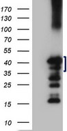 ZC3H8 Antibody - HEK293T cells were transfected with the pCMV6-ENTRY control. (Left lane) or pCMV6-ENTRY ZC3H8. (Right lane) cDNA for 48 hrs and lysed. Equivalent amounts of cell lysates. (5 ug per lane) were separated by SDS-PAGE and immunoblotted with anti-ZC3H8. (1:2000)