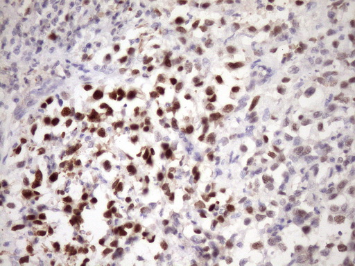 ZC3H8 Antibody - Immunohistochemical staining of paraffin-embedded Human bladder tissue within the normal limits using anti-ZC3H8 mouse monoclonal antibody. (Heat-induced epitope retrieval by Tris-EDTA, pH8.0)(1:150)