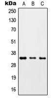 ZC3H8 Antibody - Western blot analysis of ZC3H8 expression in HepG2 (A); Raw264.7 (B); H9C2 (C) whole cell lysates.