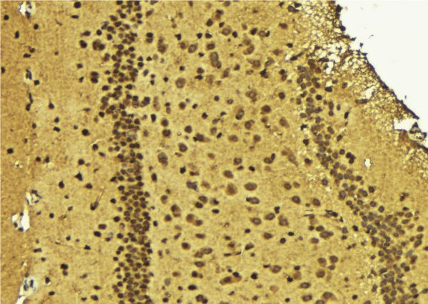 ZC3H8 Antibody - 1:100 staining mouse brain tissue by IHC-P. The sample was formaldehyde fixed and a heat mediated antigen retrieval step in citrate buffer was performed. The sample was then blocked and incubated with the antibody for 1.5 hours at 22°C. An HRP conjugated goat anti-rabbit antibody was used as the secondary.