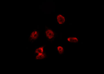 ZC3H8 Antibody - Staining HeLa cells by IF/ICC. The samples were fixed with PFA and permeabilized in 0.1% Triton X-100, then blocked in 10% serum for 45 min at 25°C. The primary antibody was diluted at 1:200 and incubated with the sample for 1 hour at 37°C. An Alexa Fluor 594 conjugated goat anti-rabbit IgG (H+L) Ab, diluted at 1/600, was used as the secondary antibody.