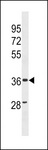 ZC3HAV1L Antibody - ZC3HAV1L Antibody western blot of human Uterus tissue lysates (35 ug/lane). The ZC3HAV1L antibody detected the ZC3HAV1L protein (arrow).