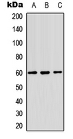 ZC3HC1 / NIPA Antibody - Western blot analysis of NIPA expression in HepG2 (A); NIH3T3 (B); human testis (C) whole cell lysates.