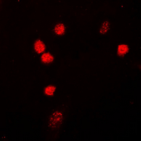 ZC3HC1 / NIPA Antibody - Immunofluorescent analysis of NIPA staining in HepG2 cells. Formalin-fixed cells were permeabilized with 0.1% Triton X-100 in TBS for 5-10 minutes and blocked with 3% BSA-PBS for 30 minutes at room temperature. Cells were probed with the primary antibody in 3% BSA-PBS and incubated overnight at 4 deg C in a humidified chamber. Cells were washed with PBST and incubated with a DyLight 594-conjugated secondary antibody (red) in PBS at room temperature in the dark. DAPI was used to stain the cell nuclei (blue).