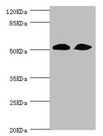 ZC3HC1 / NIPA Antibody - Western blot All Lanes:ZC3HC1 antibody at 1.08ug/ml Lane 1:Hela whole cell lysate Lane 2:mouse skeletal muscle tissue Secondary Goat polyclonal to rabbit at 1/10000 dilution Predicted band size: 56,54,48 kDa Observed band size: 55 kDa