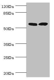 ZC3HC1 / NIPA Antibody - Western blot All Lanes:ZC3HC1 antibody at 0.98ug/ml Lane 1:Hela whole cell lysate Lane 2:mouse skeletal muscle tissue Secondary Goat polyclonal to rabbit at 1/10000 dilution Predicted band size: 56,54,48 kDa Observed band size: 55 kDa