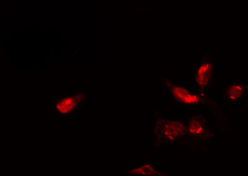 ZC3HC1 / NIPA Antibody - Staining HeLa cells by IF/ICC. The samples were fixed with PFA and permeabilized in 0.1% Triton X-100, then blocked in 10% serum for 45 min at 25°C. The primary antibody was diluted at 1:200 and incubated with the sample for 1 hour at 37°C. An Alexa Fluor 594 conjugated goat anti-rabbit IgG (H+L) Ab, diluted at 1/600, was used as the secondary antibody.