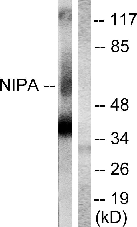 ZC3HC1 / NIPA Antibody - Western blot analysis of extracts from COS7 cells, treated with HU (2nM, 24hours), using NIPA (Ab-354) antibody.
