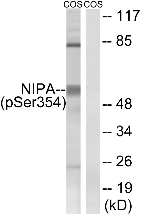 ZC3HC1 / NIPA Antibody - Western blot analysis of lysates from COS7 cells treated with HU 2nM 24h, using NIPA (Phospho-Ser354) Antibody. The lane on the right is blocked with the phospho peptide.