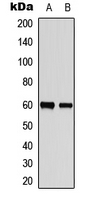ZC3HC1 / NIPA Antibody - Western blot analysis of NIPA (pS354) expression in HepG2 (A); human testis (B) whole cell lysates.