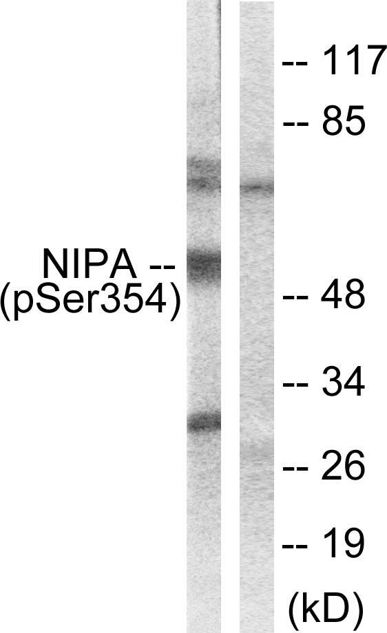 ZC3HC1 / NIPA Antibody - Western blot analysis of extracts from COS7 cells, treated with HU (2nM, 24hours), using NIPA (Phospho-Ser354) antibody.