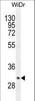 ZC4H2 Antibody - ZC4H2 Antibody western blot of WiDr cell line lysates (35 ug/lane). The ZC4H2 antibody detected the ZC4H2 protein (arrow).