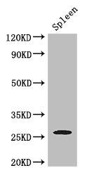 ZC4H2 Antibody - Positive WB detected in:Mouse spleen tissue;All lanes: ZC4H2 antibody at 3ug/ml;Secondary;Goat polyclonal to rabbit IgG at 1/50000 dilution;Predicted band size: 27,16,24,21,26 kDa;Observed band size: 27 kDa;