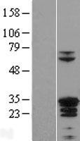 ZC4H2 Protein - Western validation with an anti-DDK antibody * L: Control HEK293 lysate R: Over-expression lysate