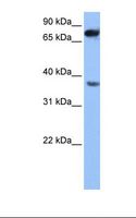 ZCCHC12 Antibody - HepG2 cell lysate. Antibody concentration: 1.0 ug/ml. Gel concentration: 12%.  This image was taken for the unconjugated form of this product. Other forms have not been tested.
