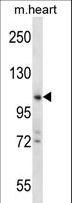 ZCCHC14 Antibody - ZCCHC14 Antibody western blot of mouse heart tissue lysates (35 ug/lane). The ZCCHC14 antibody detected the ZCCHC14 protein (arrow).