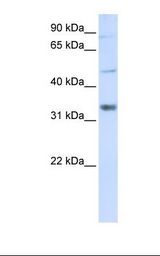 ZCCHC17 / PNO40 / PS1D Antibody - Transfected 293T cell lysate. Antibody concentration: 1.0 ug/ml. Gel concentration: 12%.  This image was taken for the unconjugated form of this product. Other forms have not been tested.