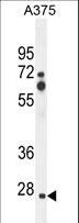 ZCCHC17 / PNO40 / PS1D Antibody - ZCCHC17 Antibody western blot of A375 cell line lysates (35 ug/lane). The ZCCHC17 antibody detected the ZCCHC17 protein (arrow).