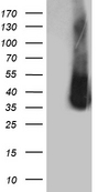 ZCCHC17 / PNO40 / PS1D Antibody - HEK293T cells were transfected with the pCMV6-ENTRY control. (Left lane) or pCMV6-ENTRY ZCCHC17. (Right lane) cDNA for 48 hrs and lysed. Equivalent amounts of cell lysates. (5 ug per lane) were separated by SDS-PAGE and immunoblotted with anti-ZCCHC17. (1:2000)
