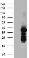 ZCCHC17 / PNO40 / PS1D Antibody - HEK293T cells were transfected with the pCMV6-ENTRY control. (Left lane) or pCMV6-ENTRY ZCCHC17. (Right lane) cDNA for 48 hrs and lysed. Equivalent amounts of cell lysates. (5 ug per lane) were separated by SDS-PAGE and immunoblotted with anti-ZCCHC17. (1:500)