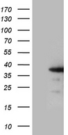 ZCCHC17 / PNO40 / PS1D Antibody - HEK293T cells were transfected with the pCMV6-ENTRY control. (Left lane) or pCMV6-ENTRY ZCCHC17. (Right lane) cDNA for 48 hrs and lysed. Equivalent amounts of cell lysates. (5 ug per lane) were separated by SDS-PAGE and immunoblotted with anti-ZCCHC17. (1:2000)