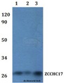 ZCCHC17 / PNO40 / PS1D Antibody - Western blot of ZCCHC17 antibody at 1:500 dilution. Lane 1: HEK293T whole cell lysate. Lane 2: RAW264.7 whole cell lysate.