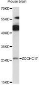 ZCCHC17 / PNO40 / PS1D Antibody - Western blot analysis of extracts of mouse brain, using ZCCHC17 antibody at 1:1000 dilution. The secondary antibody used was an HRP Goat Anti-Rabbit IgG (H+L) at 1:10000 dilution. Lysates were loaded 25ug per lane and 3% nonfat dry milk in TBST was used for blocking. An ECL Kit was used for detection and the exposure time was 30s.
