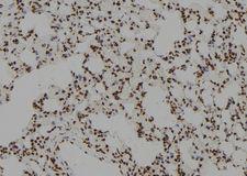 ZCCHC17 / PNO40 / PS1D Antibody - 1:100 staining rat lung tissue by IHC-P. The sample was formaldehyde fixed and a heat mediated antigen retrieval step in citrate buffer was performed. The sample was then blocked and incubated with the antibody for 1.5 hours at 22°C. An HRP conjugated goat anti-rabbit antibody was used as the secondary.
