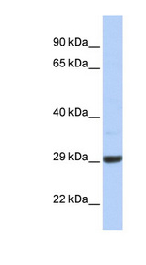 ZCCHC24 Antibody - ZCCHC24 antibody Western blot of Jurkat lysate. This image was taken for the unconjugated form of this product. Other forms have not been tested.