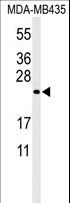 ZCCHC24 Antibody - Western blot of ZCH24 Antibody in MDA-MB435 cell line lysates (35 ug/lane). ZCH24 (arrow) was detected using the purified antibody.