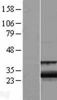 ZCCHC24 Protein - Western validation with an anti-DDK antibody * L: Control HEK293 lysate R: Over-expression lysate