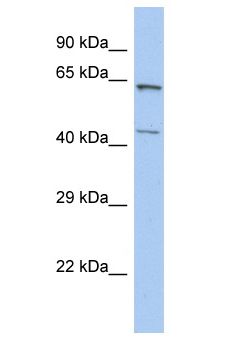 ZCCHC3 Antibody - ZCCHC3 antibody Western Blot of HT1080. Antibody dilution: 1 ug/ml.  This image was taken for the unconjugated form of this product. Other forms have not been tested.