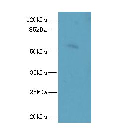 ZCCHC4 Antibody - Western blot. All lanes: ZCCHC4 antibody at 0.6 ug/ml+ A431 whole cell lysate Goat polyclonal to rabbit at 1:10000 dilution. Predicted band size: 54 kDa. Observed band size: 54 kDa.