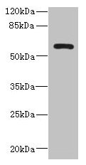 ZCCHC4 Antibody - Western blot All lanes: ZCCHC4 antibody at 0.6µg/ml + A431 whole cell lysate Secondary Goat polyclonal to rabbit IgG at 1/10000 dilution Predicted band size: 60, 26, 59 kDa Observed band size: 60 kDa