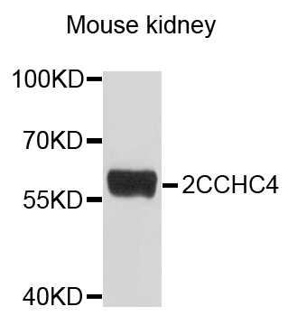 ZCCHC4 Antibody - Western blot analysis of extracts of mouse kidney, using ZCCHC4 antibody at 1:1000 dilution. The secondary antibody used was an HRP Goat Anti-Rabbit IgG (H+L) at 1:10000 dilution. Lysates were loaded 25ug per lane and 3% nonfat dry milk in TBST was used for blocking. An ECL Kit was used for detection and the exposure time was 30s.