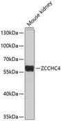 ZCCHC4 Antibody - Western blot analysis of extracts of mouse kidney using ZCCHC4 Polyclonal Antibody at dilution of 1:1000.