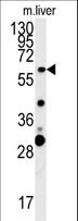 ZCCHC5 Antibody - ZCCHC5 Antibody western blot of mouse liver tissue lysates (15 ug/lane). The ZCCHC5 antibody detected ZCCHC5 protein (arrow).