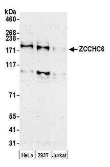 ZCCHC6 Antibody - Detection of human ZCCHC6 by western blot. Samples: Whole cell lysate (50 µg) from HeLa, HEK293T, and Jurkat cells prepared using NETN lysis buffer. Antibody: Affinity purified rabbit anti-ZCCHC6 antibody used for WB at 0.04 µg/ml. Detection: Chemiluminescence with an exposure time of 3 minutes.