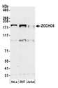 ZCCHC6 Antibody - Detection of human ZCCHC6 by western blot. Samples: Whole cell lysate (50 µg) from HeLa, HEK293T, and Jurkat cells prepared using NETN lysis buffer. Antibody: Affinity purified rabbit anti-ZCCHC6 antibody used for WB at 0.1 µg/ml. Detection: Chemiluminescence with an exposure time of 3 minutes.