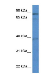 ZCCHC7 Antibody - ZCCHC7 antibody Western blot of Jurkat lysate.  This image was taken for the unconjugated form of this product. Other forms have not been tested.