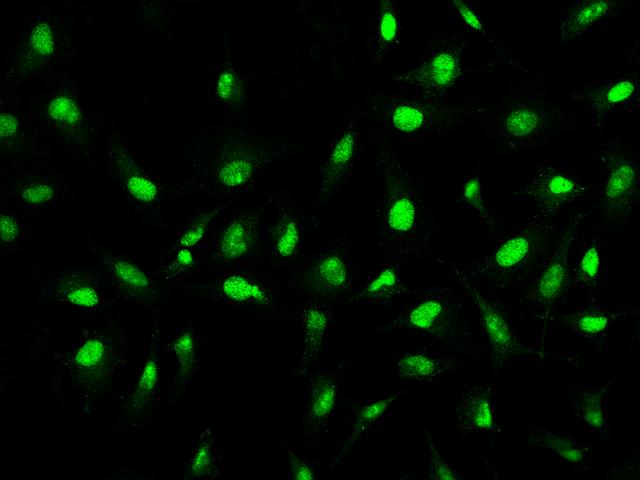 ZCCHC9 Antibody - Immunofluorescence staining of ZCCHC9 in Hela cells. Cells were fixed with 4% PFA, permeabilzed with 0.1% Triton X-100 in PBS, blocked with 10% serum, and incubated with rabbit anti-Human ZCCHC9 polyclonal antibody (dilution ratio 1:200) at 4°C overnight. Then cells were stained with the Alexa Fluor 488-conjugated Goat Anti-rabbit IgG secondary antibody (green). Positive staining was localized to Nucleus.