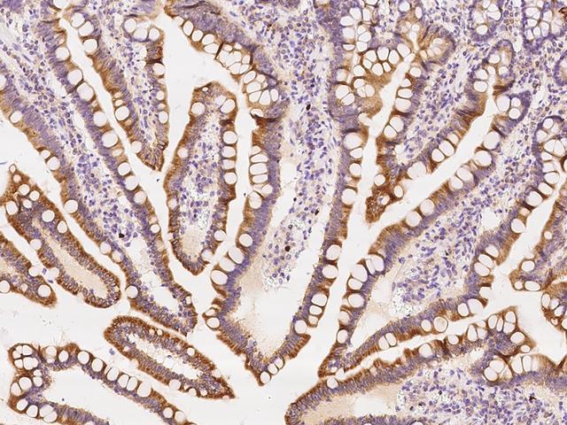 ZCCHC9 Antibody - Immunochemical staining of human ZCCHC9 in human duodenum with rabbit polyclonal antibody at 1:100 dilution, formalin-fixed paraffin embedded sections.