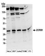 ZCRB1 Antibody - Detection of human and mouse ZCRB1 by western blot. Samples: Whole cell lysate (50 µg) from HeLa, HEK293T, Jurkat, mouse TCMK-1, and mouse NIH 3T3 cells prepared using NETN lysis buffer. Antibodies: Affinity purified rabbit anti-ZCRB1 antibody used for WB at 0.1 µg/ml. Detection: Chemiluminescence with an exposure time of 3 minutes.