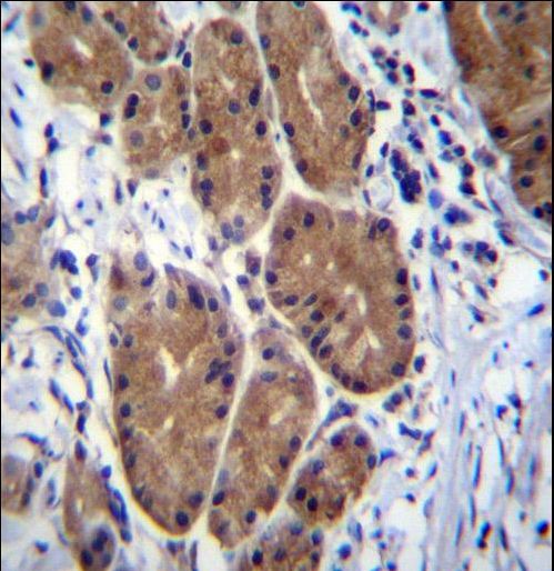 ZCRB1 Antibody - ZCRB1 Antibody immunohistochemistry of formalin-fixed and paraffin-embedded human stomach tissue followed by peroxidase-conjugated secondary antibody and DAB staining.