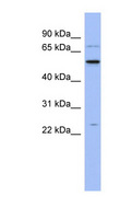 ZCRB1 Antibody - ZCRB1 antibody Western blot of Fetal Spleen lysate. This image was taken for the unconjugated form of this product. Other forms have not been tested.