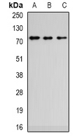 ZCWPW1 Antibody - Western blot analysis of ZCWPW1 expression in SW480 (A); HepG2 (B); mouse brain (C) whole cell lysates.
