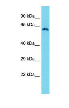 ZCWPW1 Antibody - Western blot of Human HT1080. ZCWPW1 antibody dilution 1.0 ug/ml.  This image was taken for the unconjugated form of this product. Other forms have not been tested.