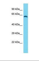 ZCWPW1 Antibody - Western blot of Human HT1080. ZCWPW1 antibody dilution 1.0 ug/ml.  This image was taken for the unconjugated form of this product. Other forms have not been tested.