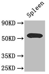 ZDHHC1 Antibody - Positive WB detected in:Mouse spleen tissue;All lanes: C16orf1 antibody at 2.6ug/ml;Secondary;Goat polyclonal to rabbit IgG at 1/50000 dilution;Predicted band size: 55 kDa;Observed band size: 55 kDa;