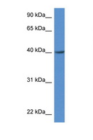 ZDHHC11 Antibody - ZDHHC11 antibody Western blot of Rat Muscle lysate. Antibody concentration 1 ug/ml.  This image was taken for the unconjugated form of this product. Other forms have not been tested.